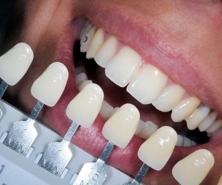 centro de implantes dentales cali
